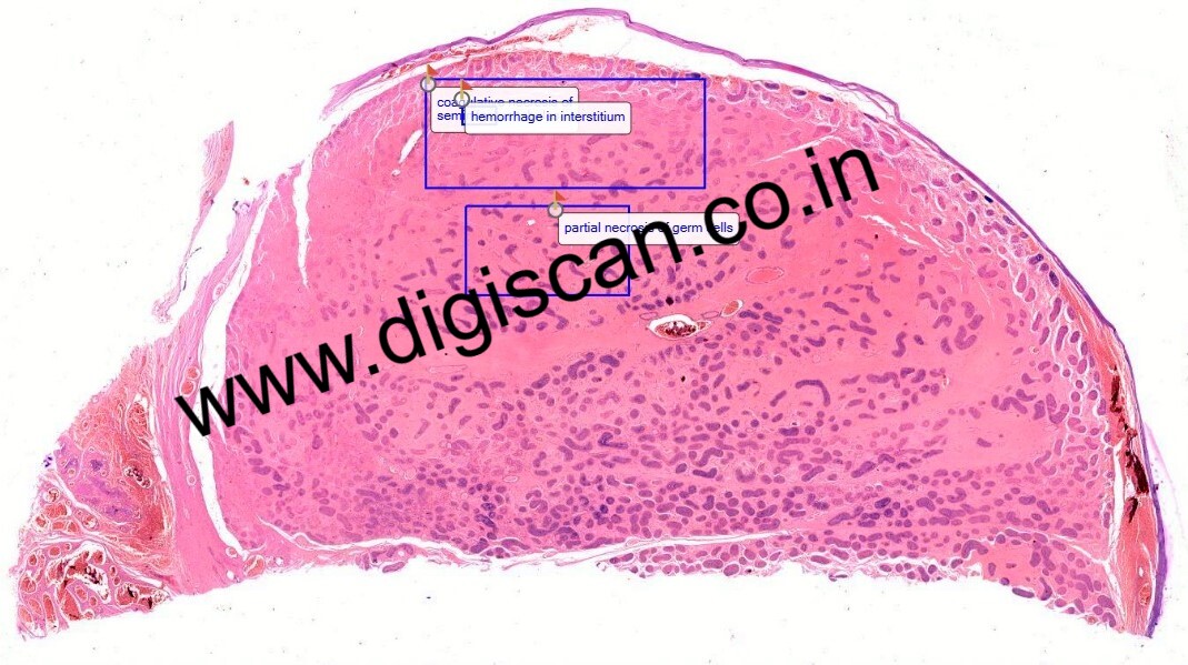 MBBS General Pathology Digital Slides Set (Microscopic Pathology)